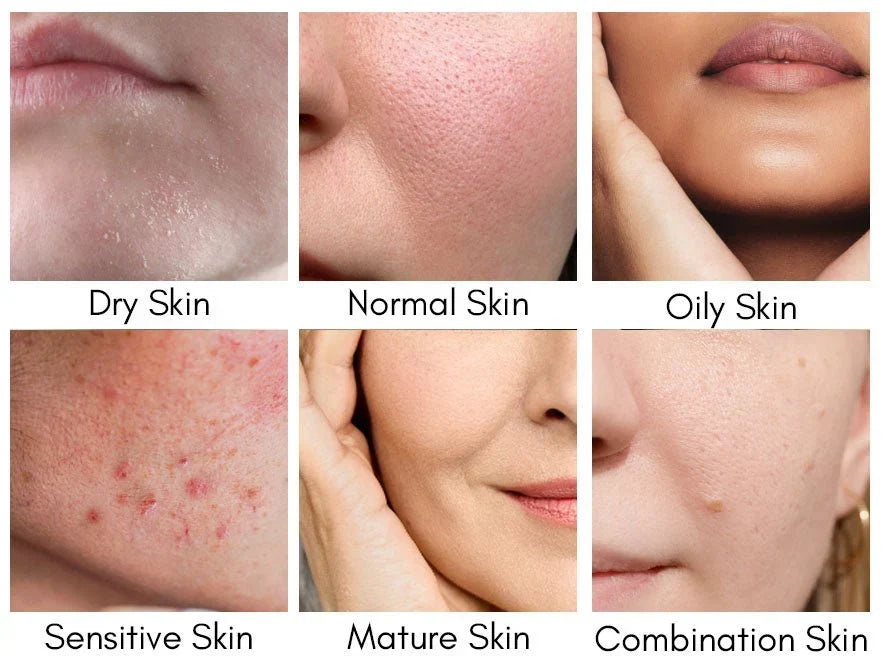 Dry, Sensitive or Dehydrated Skin? Understanding the Difference