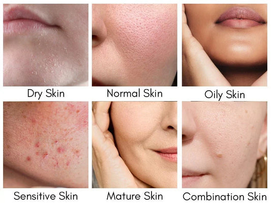 Dry, Sensitive or Dehydrated Skin? Understanding the Difference
