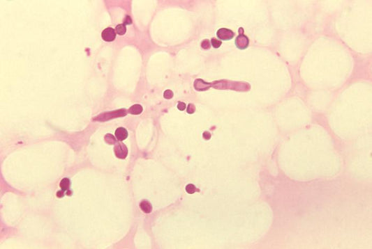 Malassezia Yeast and Skin: What Is It and Why Does It Matter?
