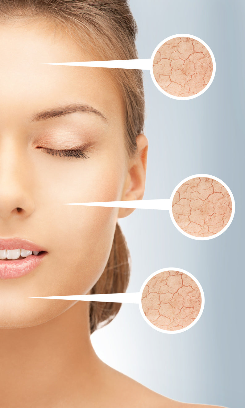 Understanding Seborrheic Dermatitis — Causes, Triggers, and What’s Really Happening on Your Skin