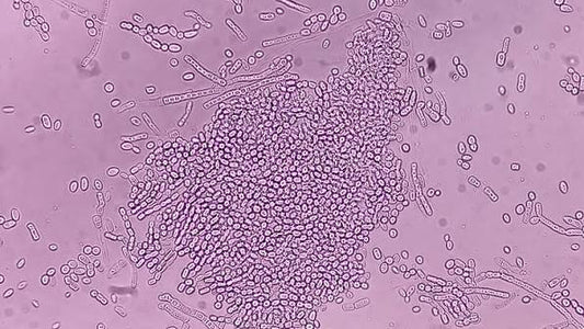 Why Does Dandruff Keep Coming Back? The Role of Malassezia and Seborrheic Dermatitis