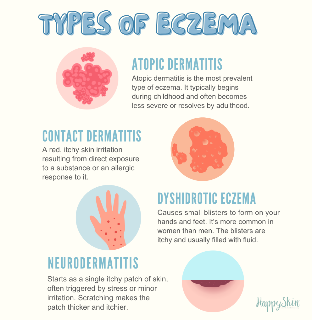 Is Eczema Genetic? What Family History Really Means