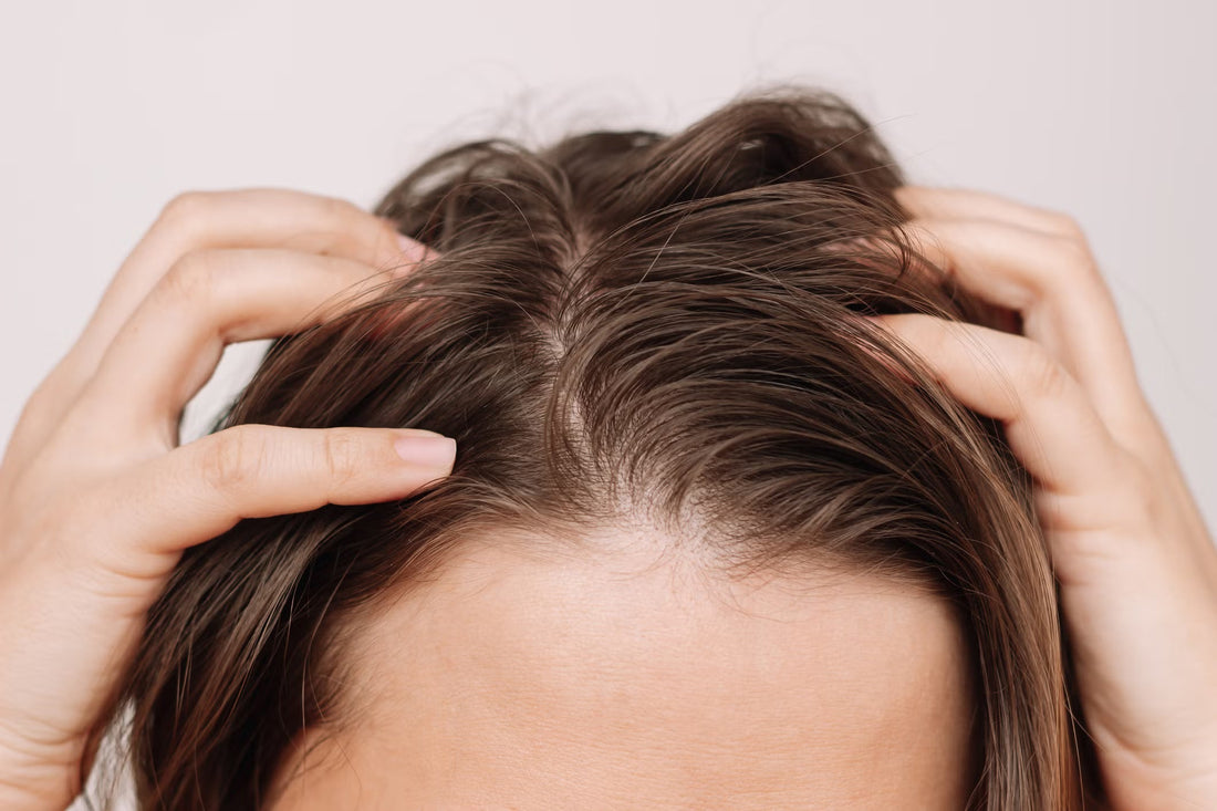 Dry Scalp, Dandruff or Seborrheic Dermatitis? Understanding the Difference
