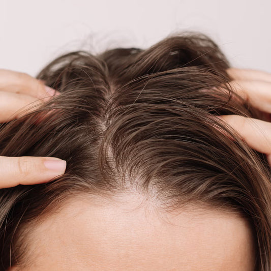 Rebuilding the Scalp Barrier — Why Long-Term Control Matters More Than “Quick Fixes”