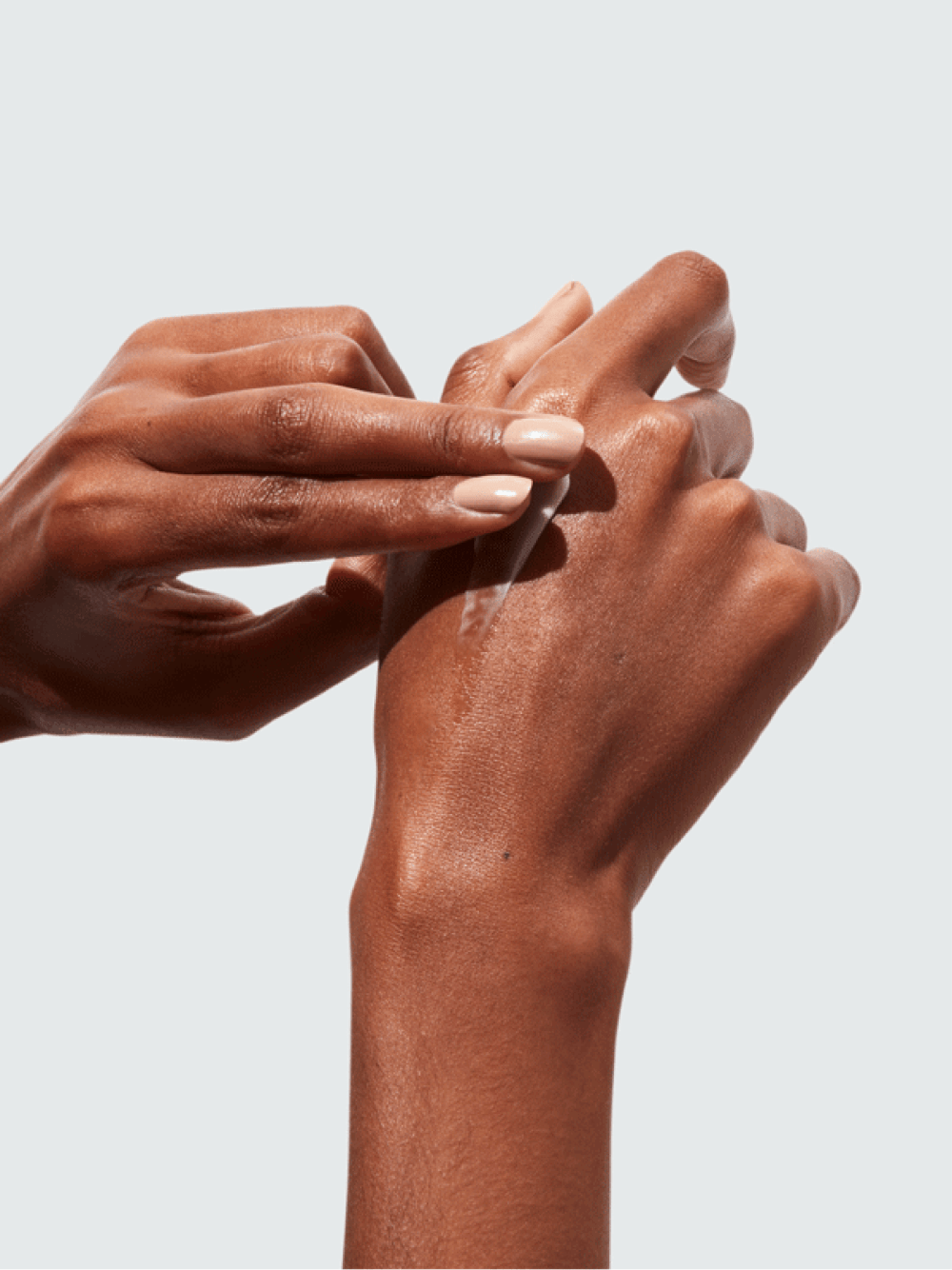 Women applying Balm onto Hand Eczema 