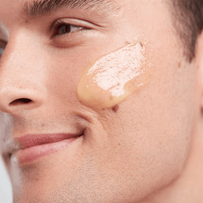 Man applying Soothing Balm onto seborrheic dermatitis