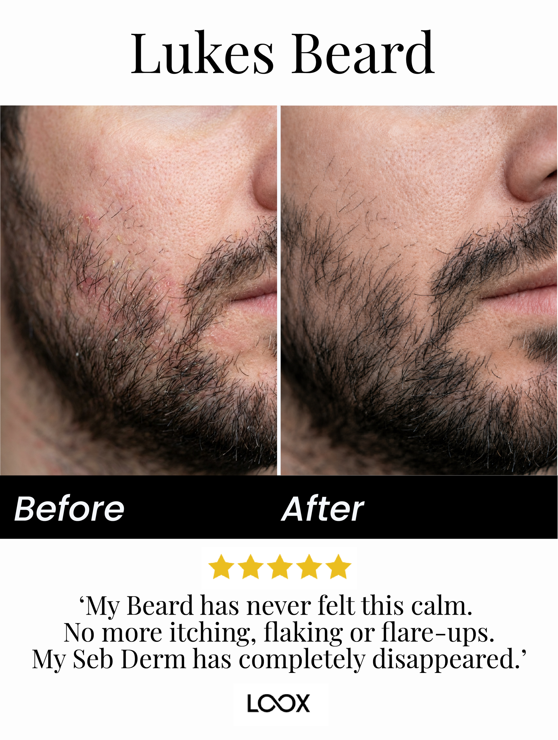 Seb Natural Calming Serum