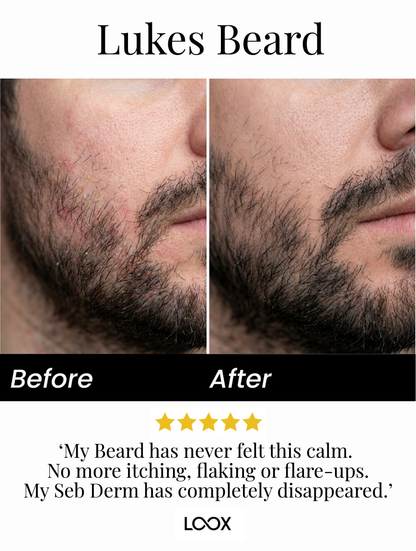 Seb Natural Calming Serum