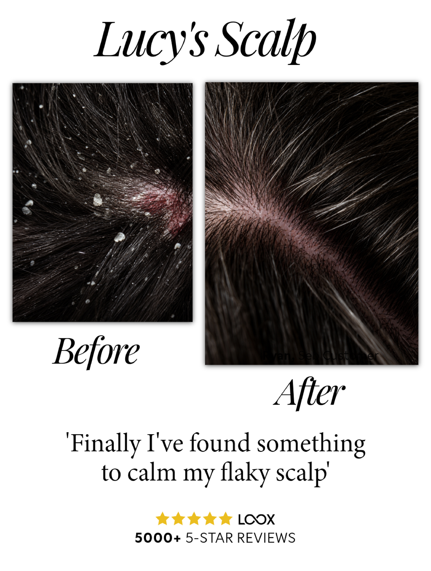 Seb Natural Calming Serum