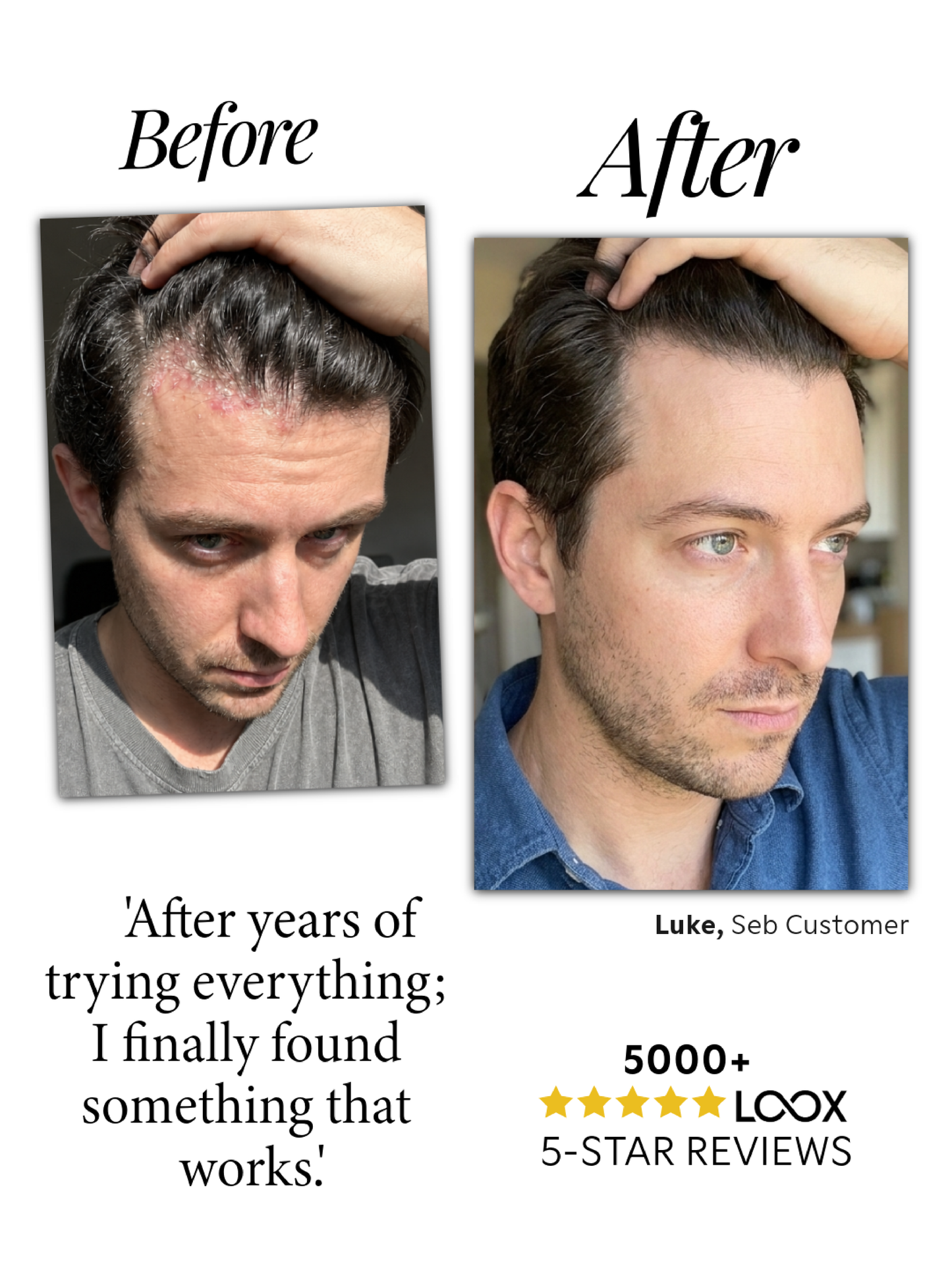 Seb Natural Calming Serum