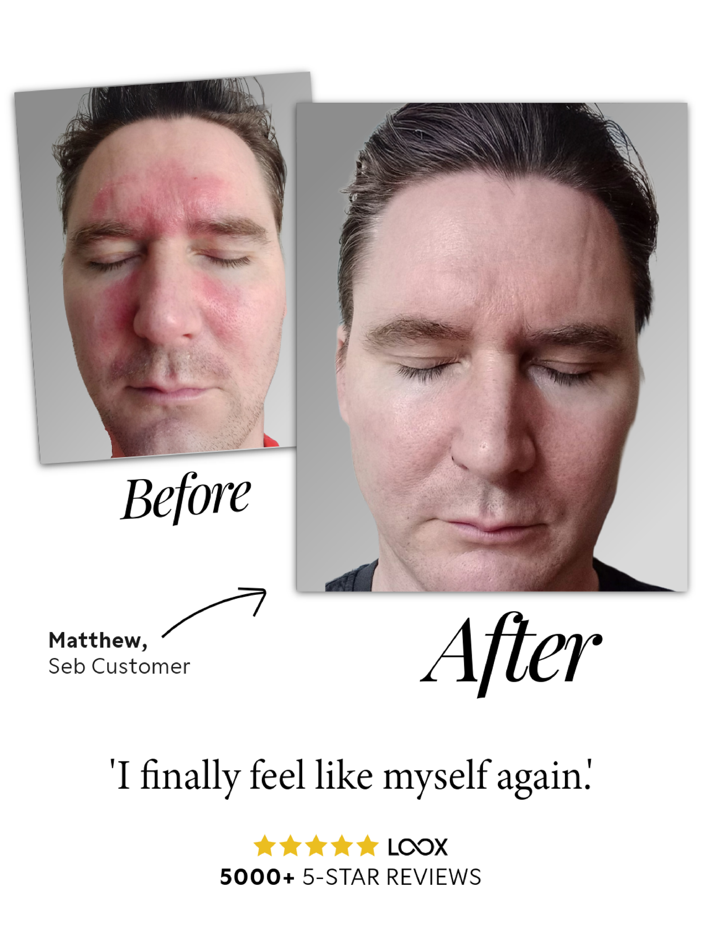 Seb Natural Calming Serum