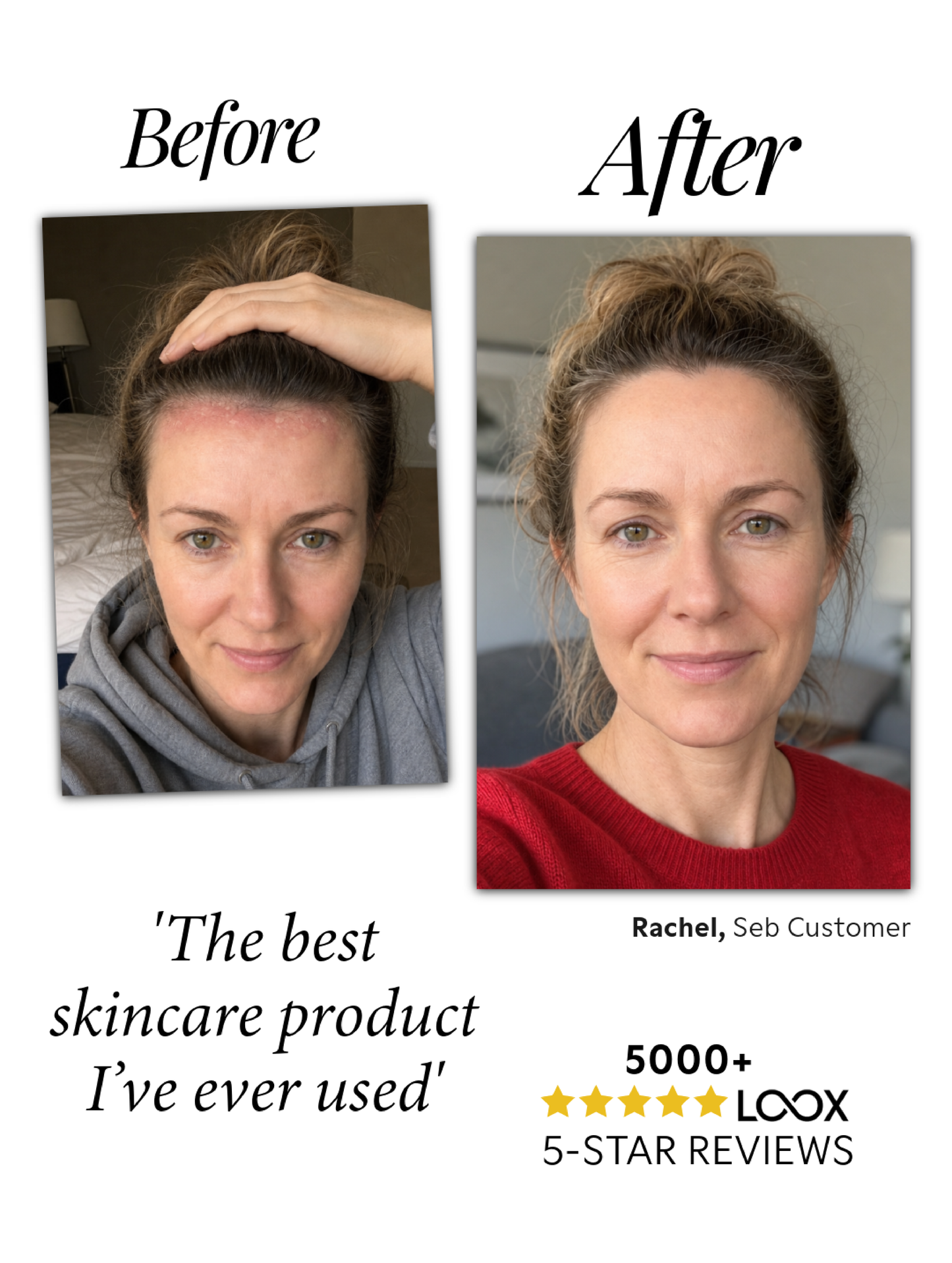 Seb Natural Calming Serum