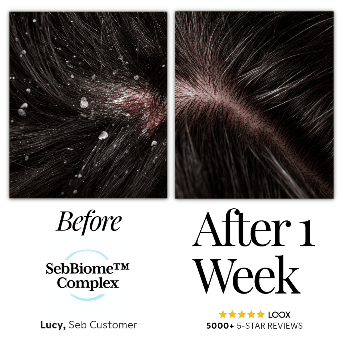 Seb Natural Calming Serum – Seb Skincare