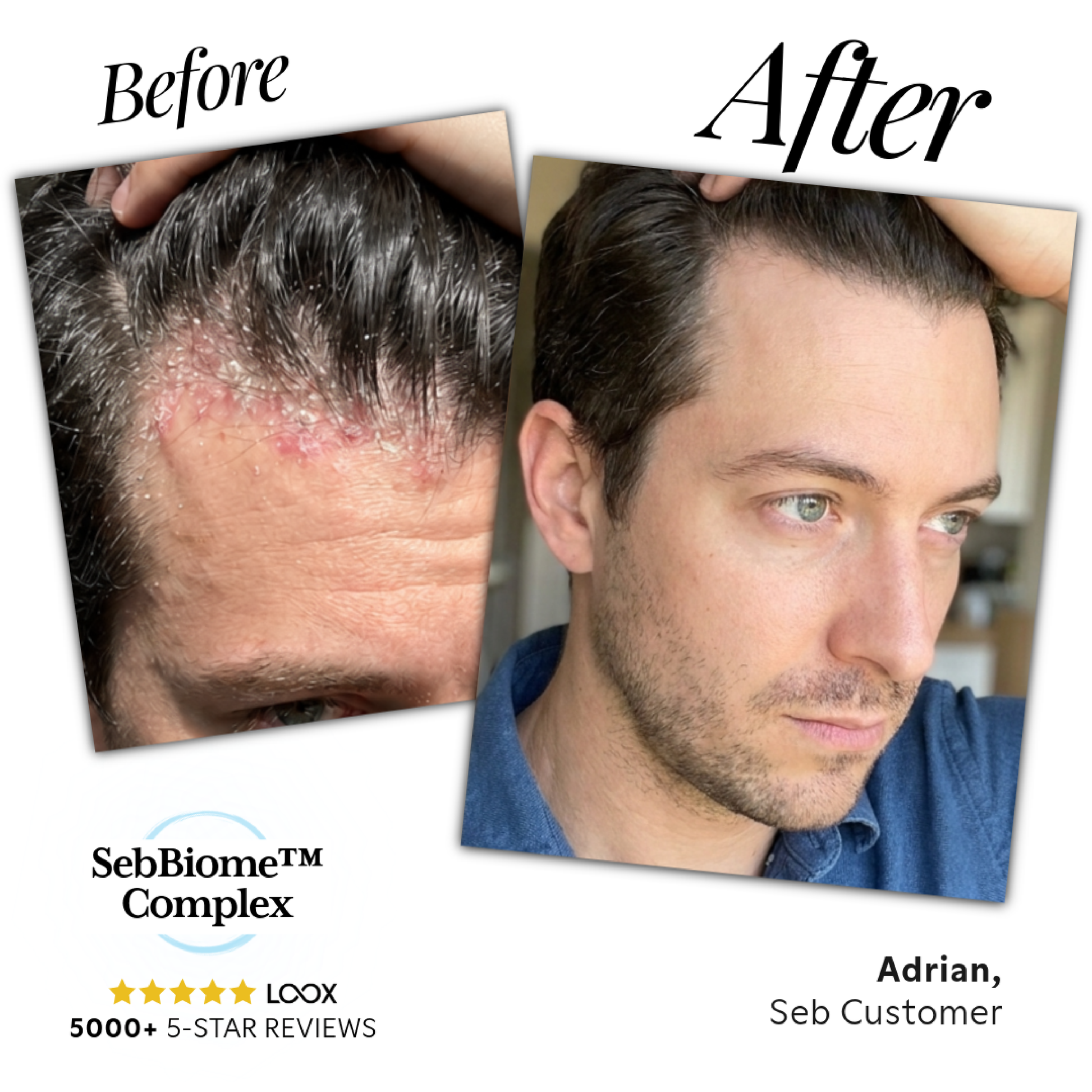 Seb Natural Calming Serum