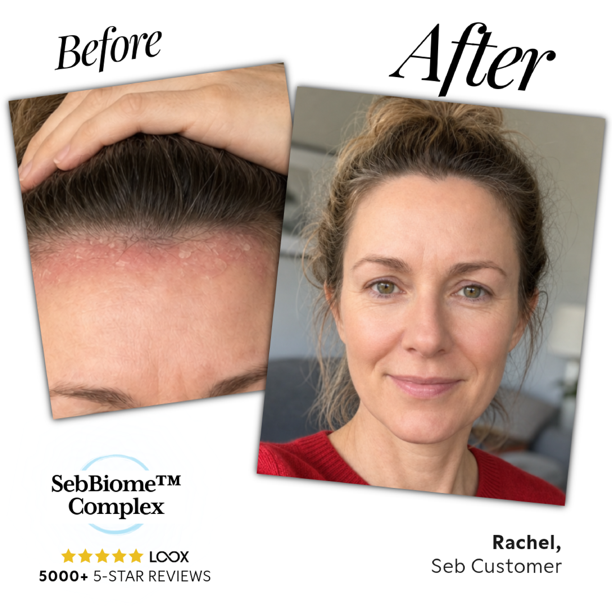 Seb Natural Calming Serum