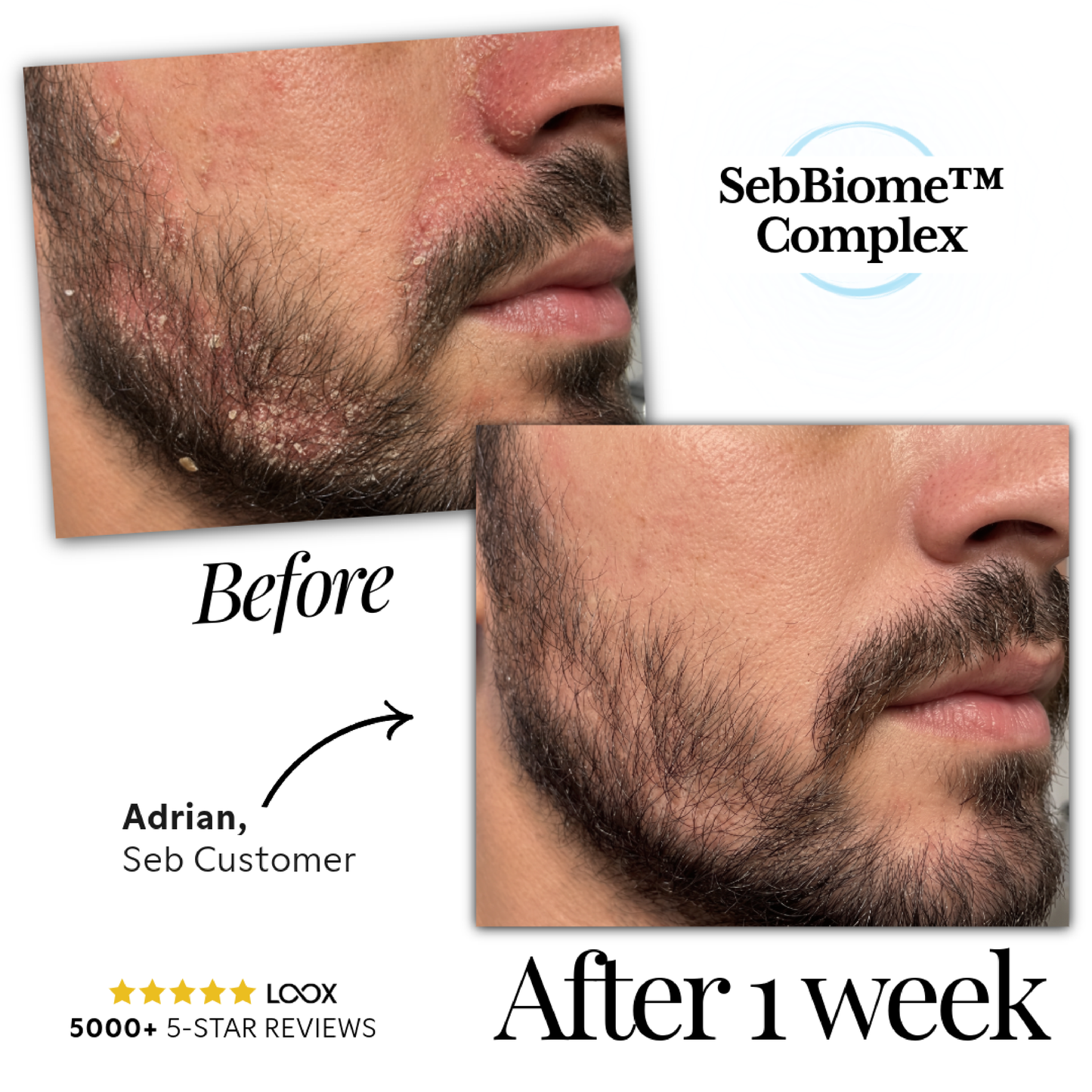 Seb Natural Calming Serum