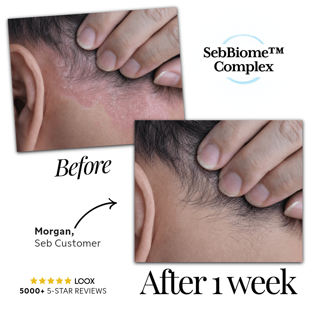 Seb Natural Calming Serum