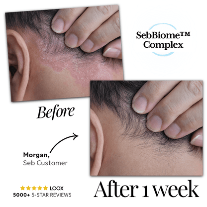 Seb Natural Calming Serum