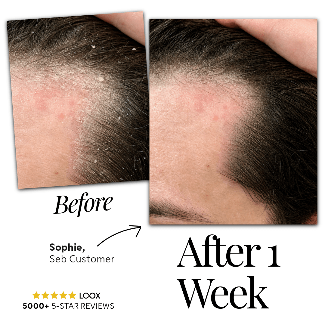 Seb Natural Calming Serum