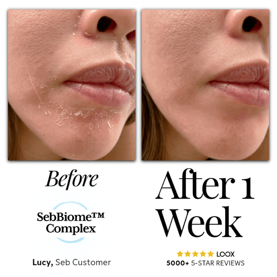 Natural & Effective Skincare | Seb Skincare
