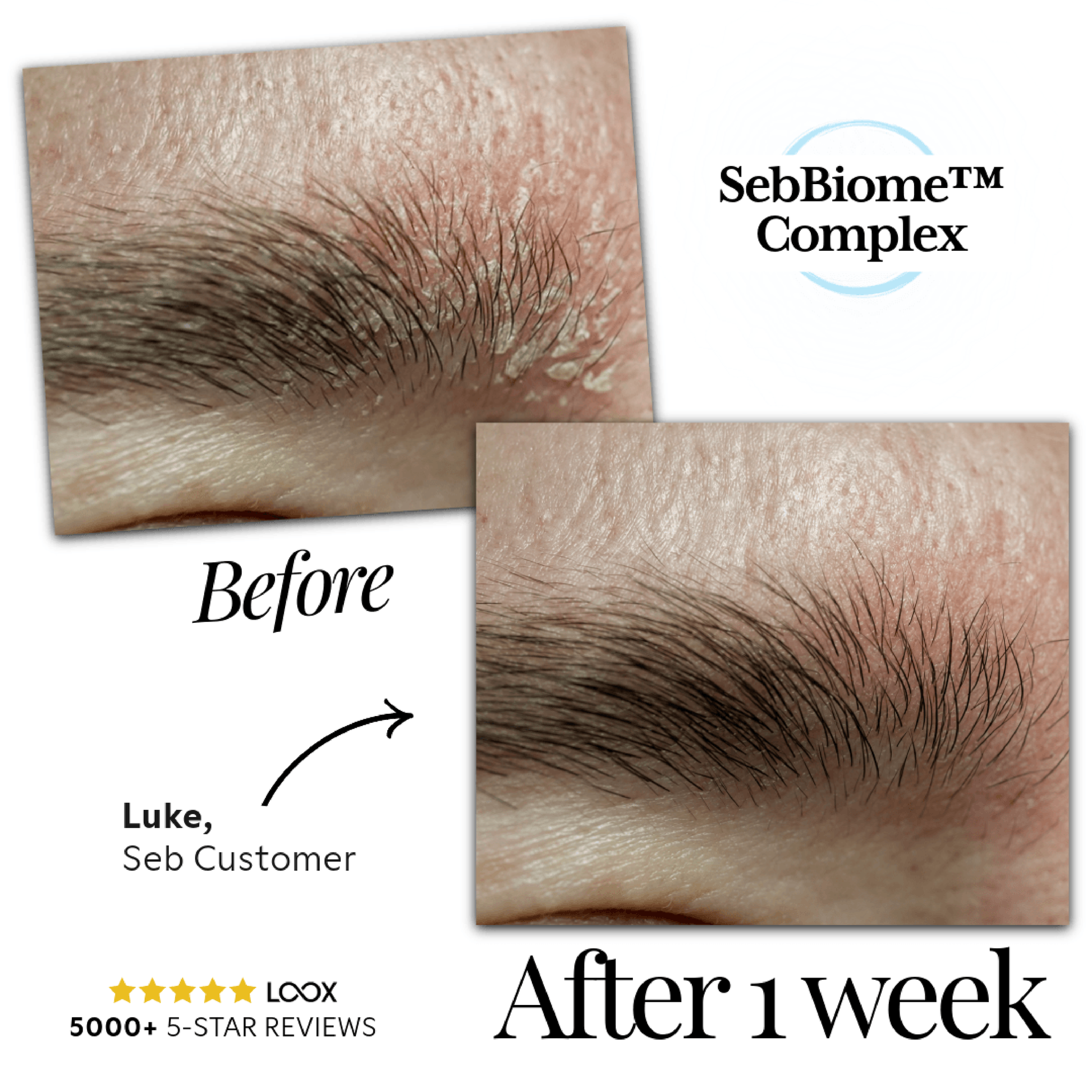 Seb Natural Calming Serum