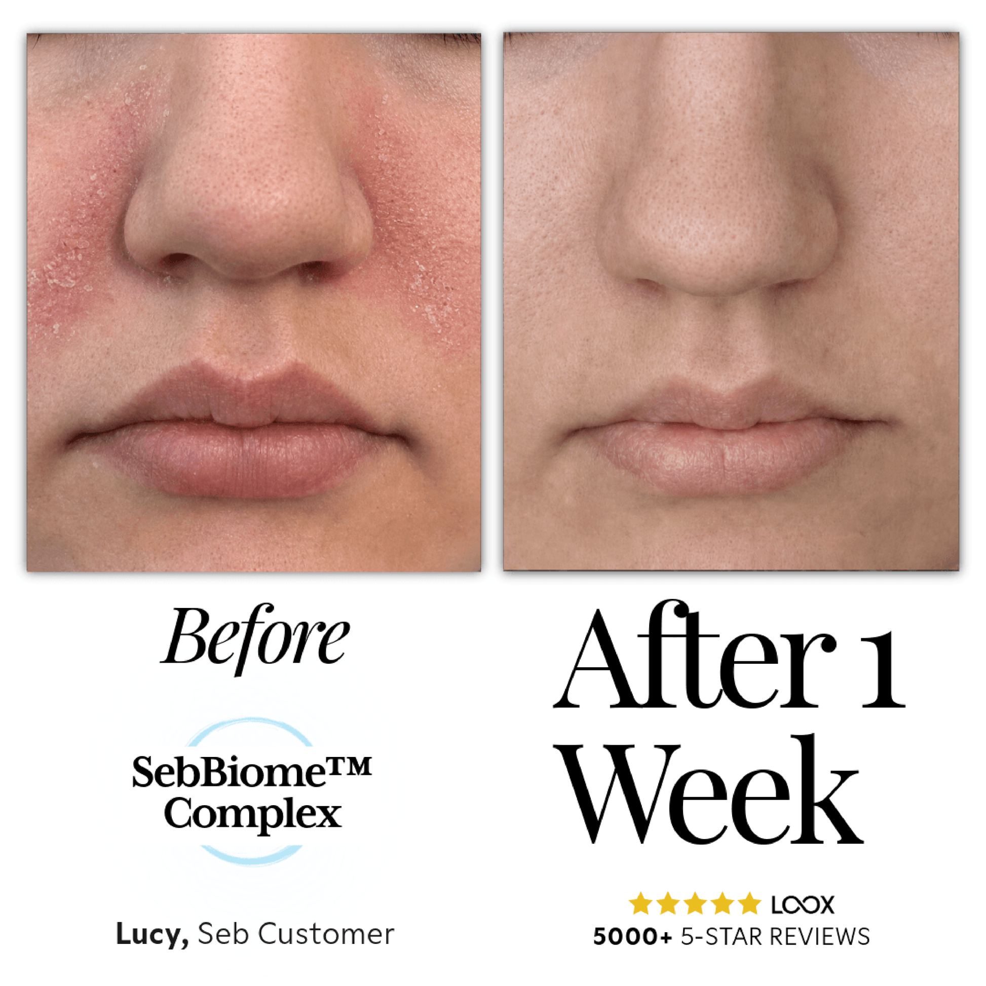 Seb Natural Calming Serum