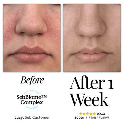 Seb Natural Calming Serum