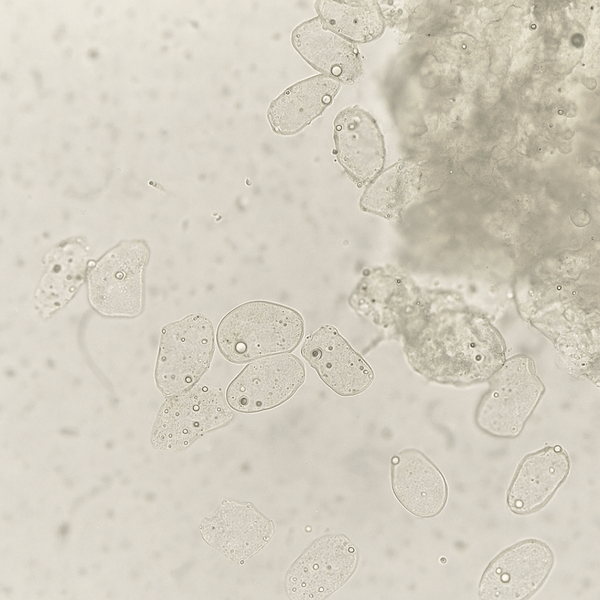 Levure Malassezia