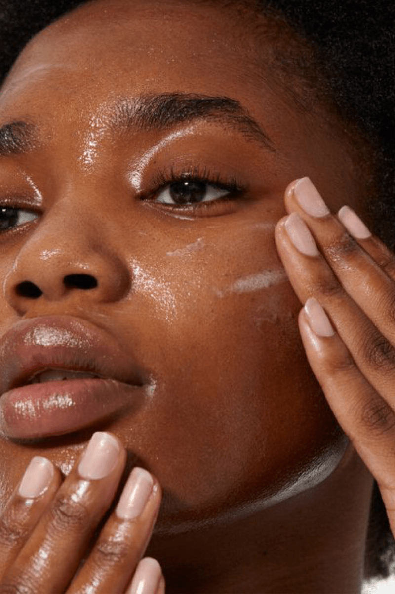 Women applying Soothing Balm onto seborrheic dermatitis