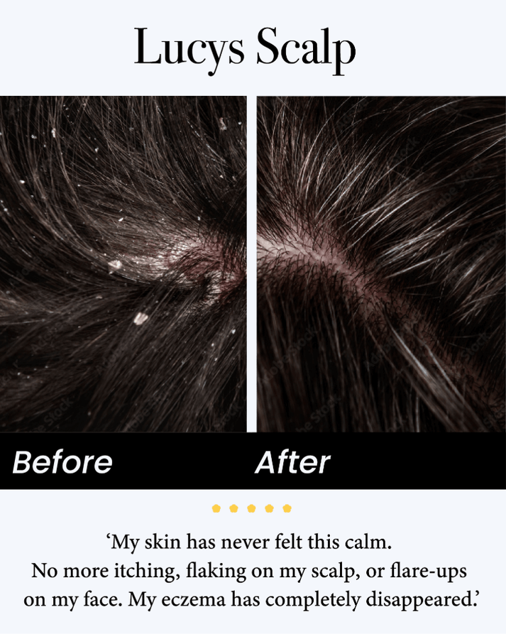 Seb Natural Calming Serum – Seb Skincare